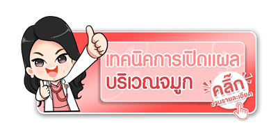 เทคนิคการเปิดแผลบริเวณจมูก เทคนิคการเปิดแผลบริเวณจมูก