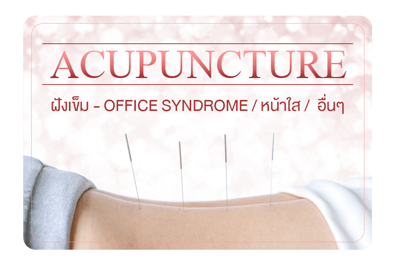 ฝังเข็ม – Acupuncture