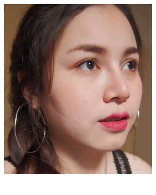 tonliew clinic-review4