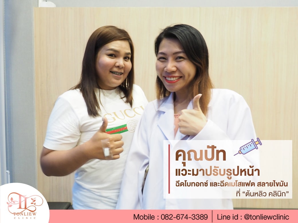 คุณปัท ปรับรูปหน้า ต้นหลิวคลินิก