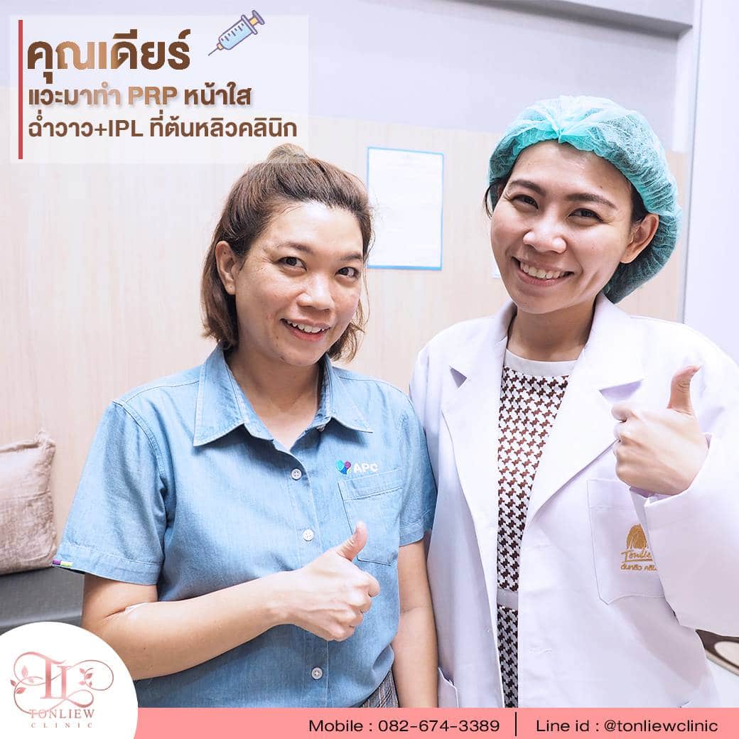 รีวิวทำ PRP และ IPL ต้นหลิวคลินิก