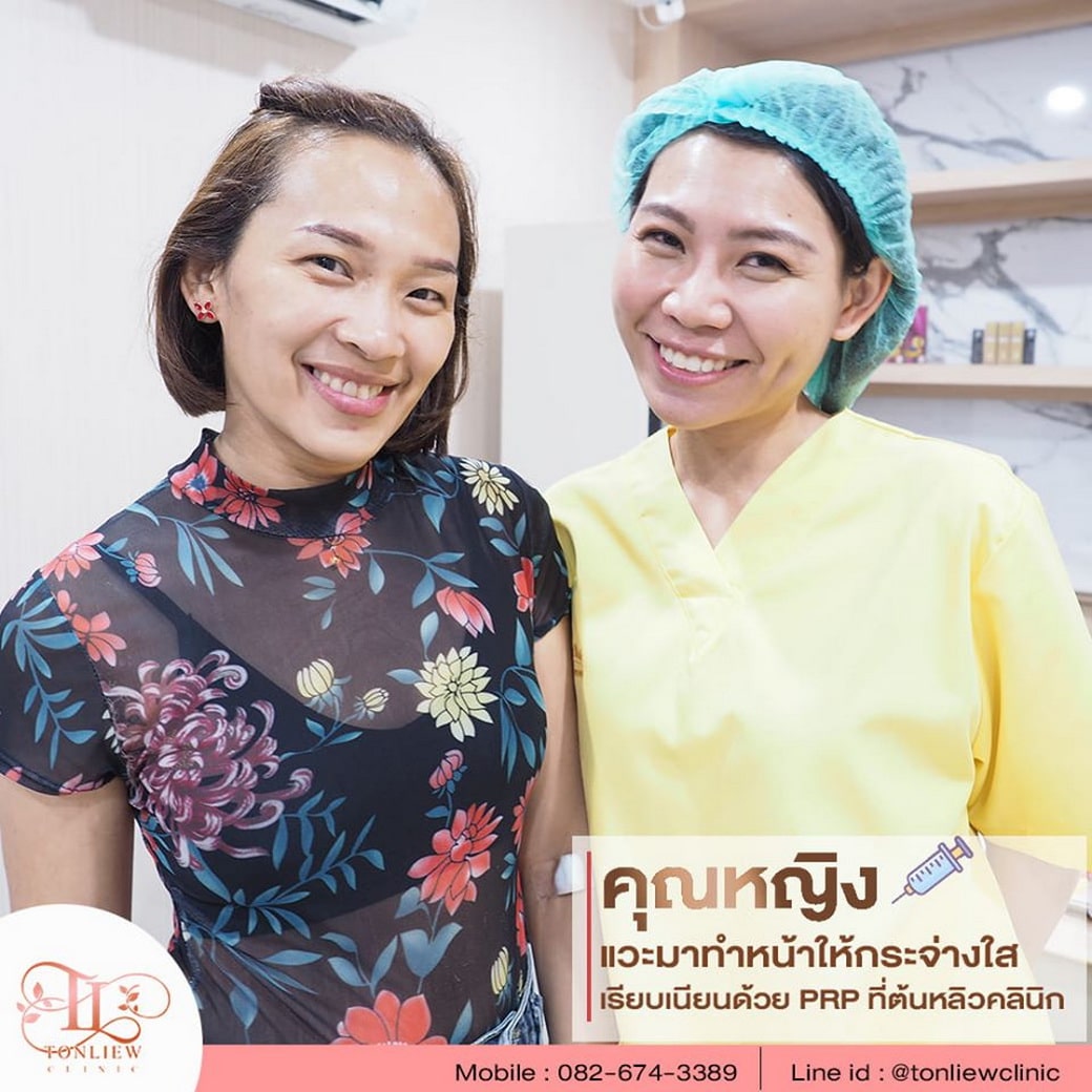 รีวิวทำ PRP ต้นหลิวคลินิก