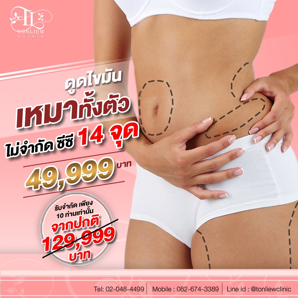 ดูดไขมันหน้าท้อง ราคา