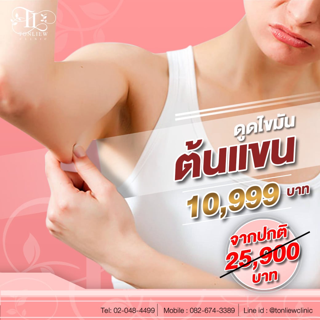 ดูดไขมันต้นแขน ไม่จำกัดซีซี