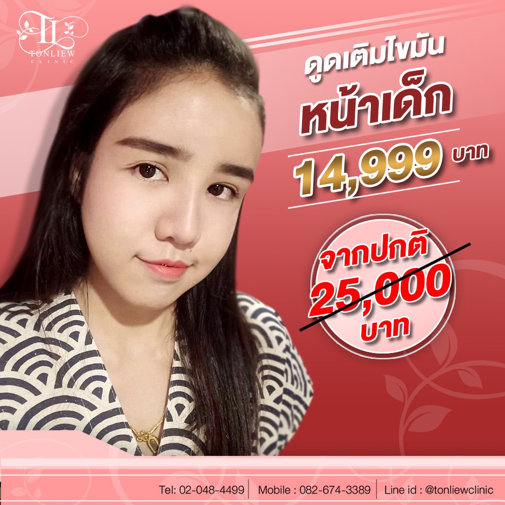 ดูดเติมไขมันหน้าเด็ก