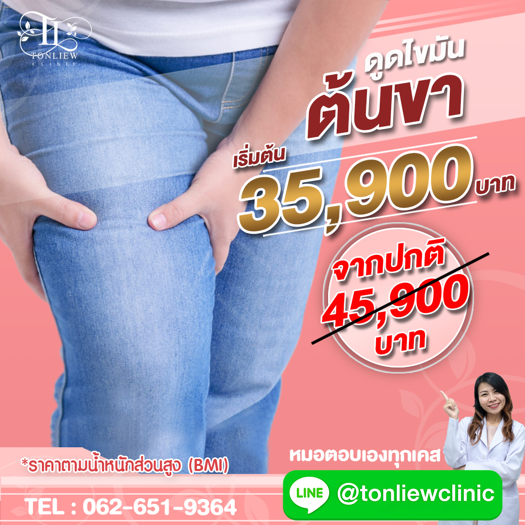 โปรโมชั่น ดูดไขมันต้นขา ราคาถูก ต้นหลิวคลินิก