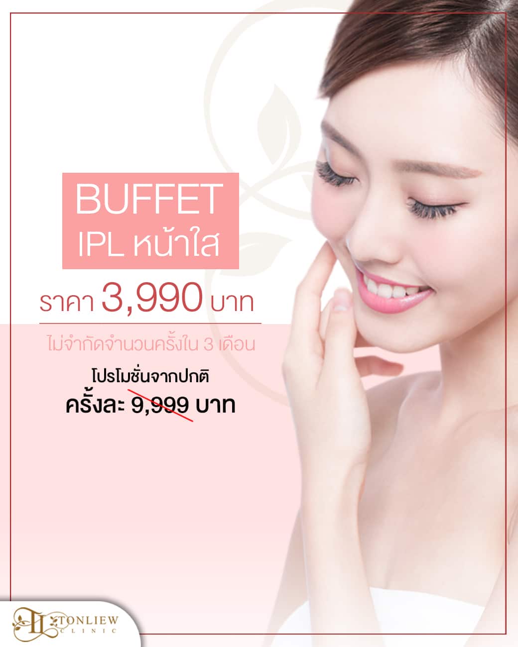 โปรโมชั่น IPL หน้าใส เหมา