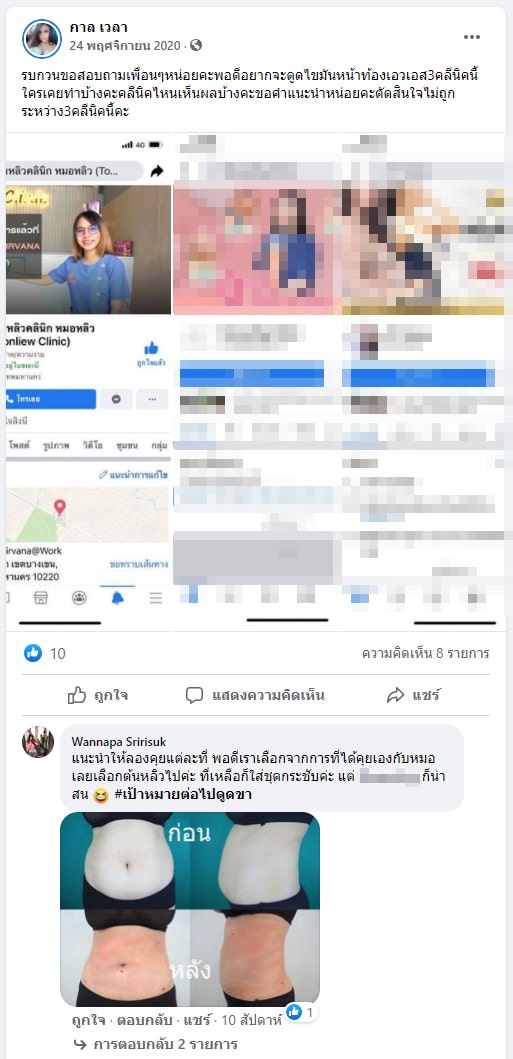รีวิวดูดไขมัน ต้นหลิวคลินิก