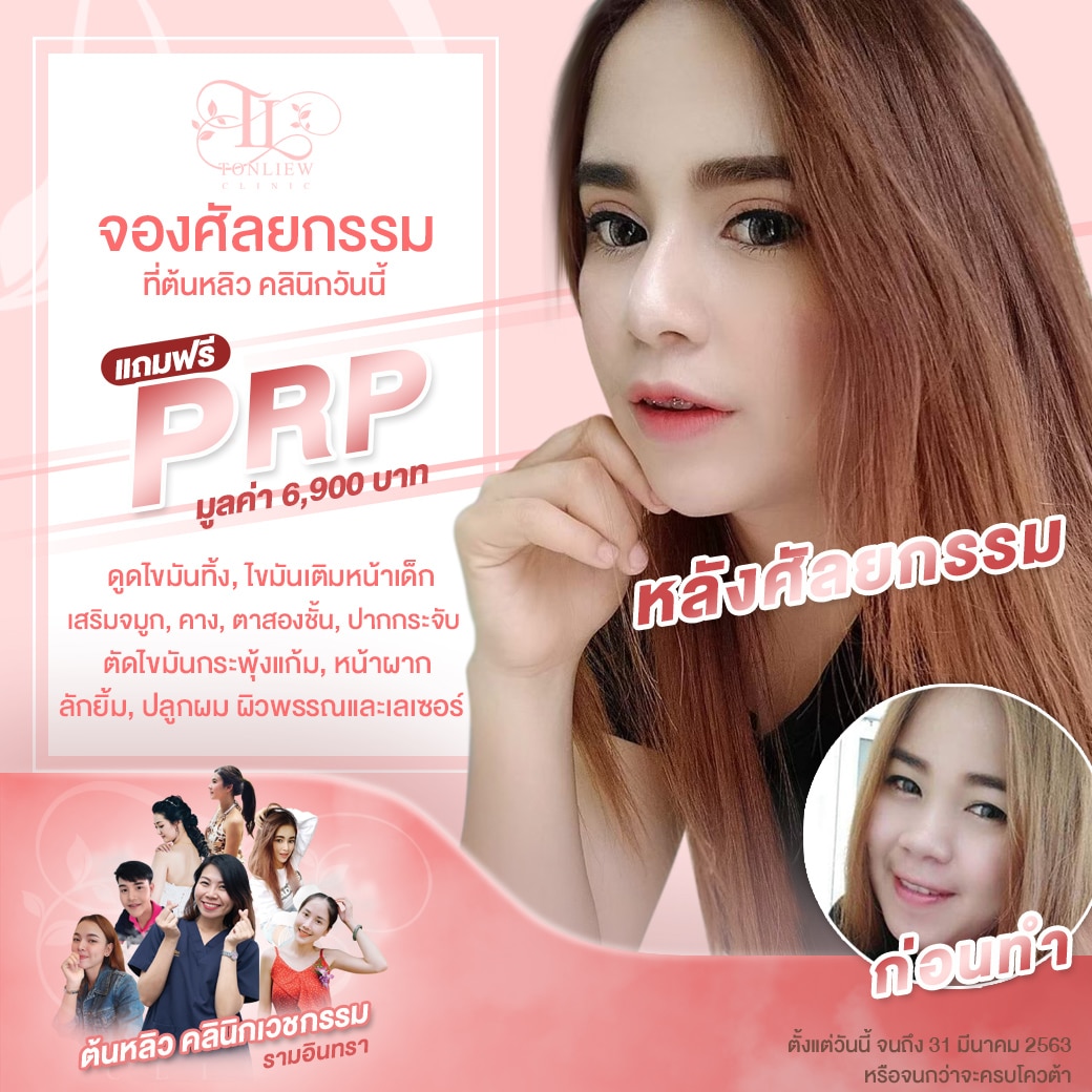 จองศัลยกรรม ต้นหลิวคลินิก แถม ฟรี PRP