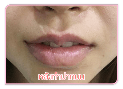 รูปทรงของปากจะเริ่มเข้าที่มากขึ้น