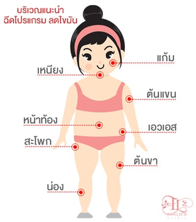 บริเวณที่ทำฉีดโปรแกรมลดไขมัน เมโสแฟต (meso fat) บริเวณที่ทำฉีดโปรแกรมลดไขมัน เมโสแฟต (meso fat)