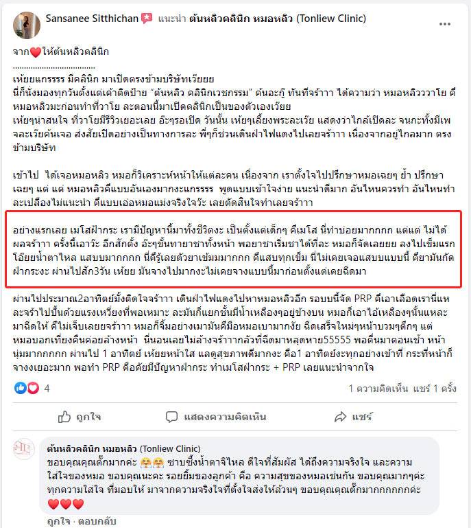 รีวิวลูกค้าทำเมโส ฝ้ากระ ต้นหลิวคลินิก