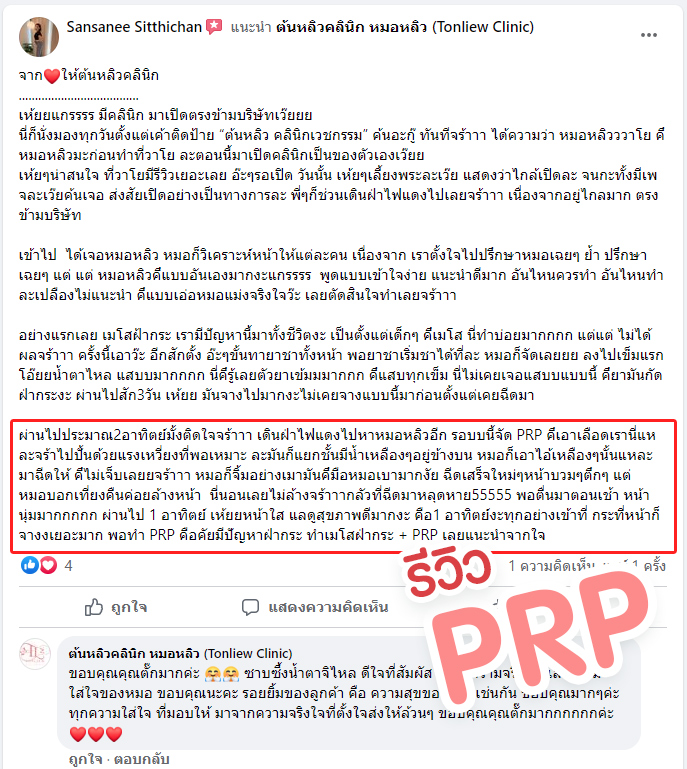 รีวิวผลลัพธ์ ฉีด PRP