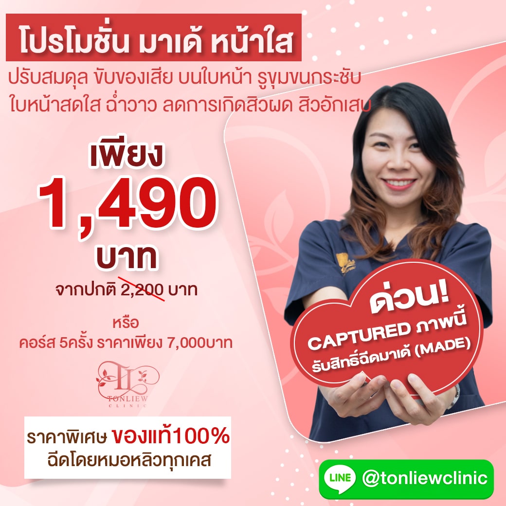 โปรโมชั่น มาเด้หน้าใส ราคาถูก 1,490บาท