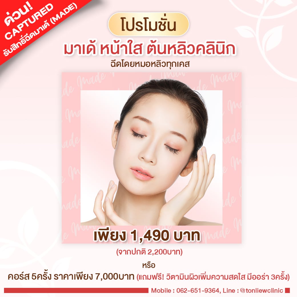 โปรโมชั่น มาเด้หน้าใส ราคา 1490บาท