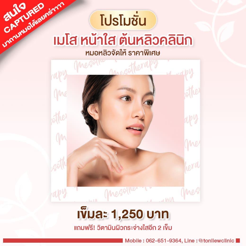 โปรโมชั่น Mesotherapy เมโส ราคา 1250บาท