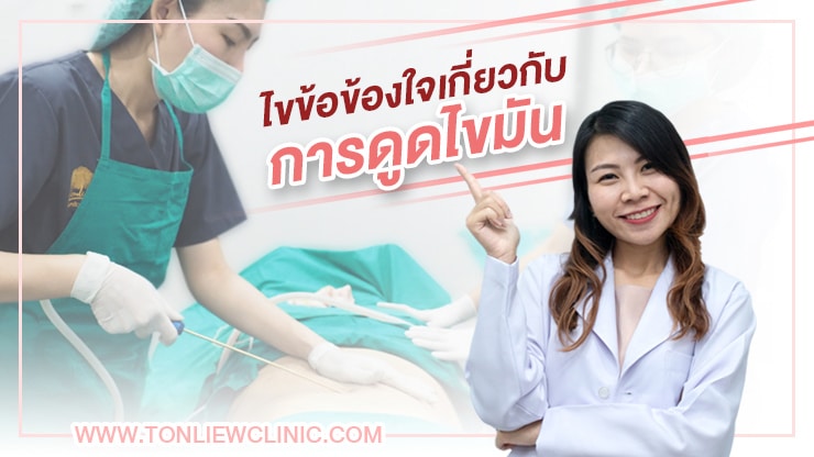 ถามตอบข้องใจเกี่ยวกับ การดูดไขมัน