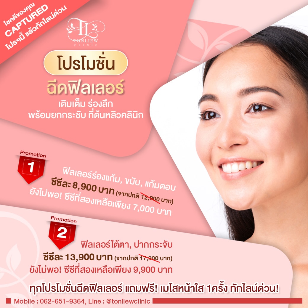 ราคาโปรโมชั่นฉีดฟิลเลอร์ FILLER เติมเต็ม ร่องลึก พร้อมยกกระชับ 8900บาท
