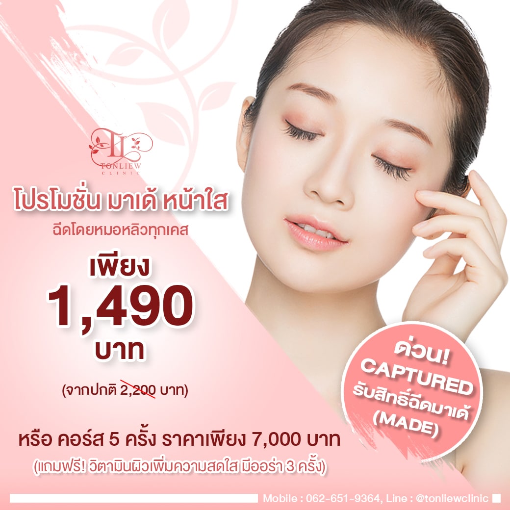 โปรโมชั่น มาเด้หน้าใส ราคา 1490บาท