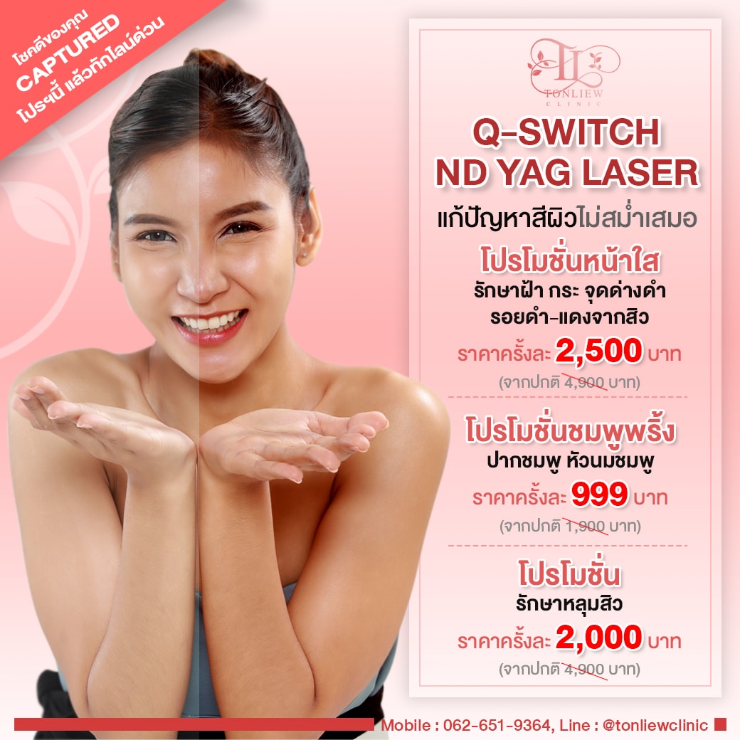 ราคาโปรโมชั่น Q-SWITCH ND YAG LASER