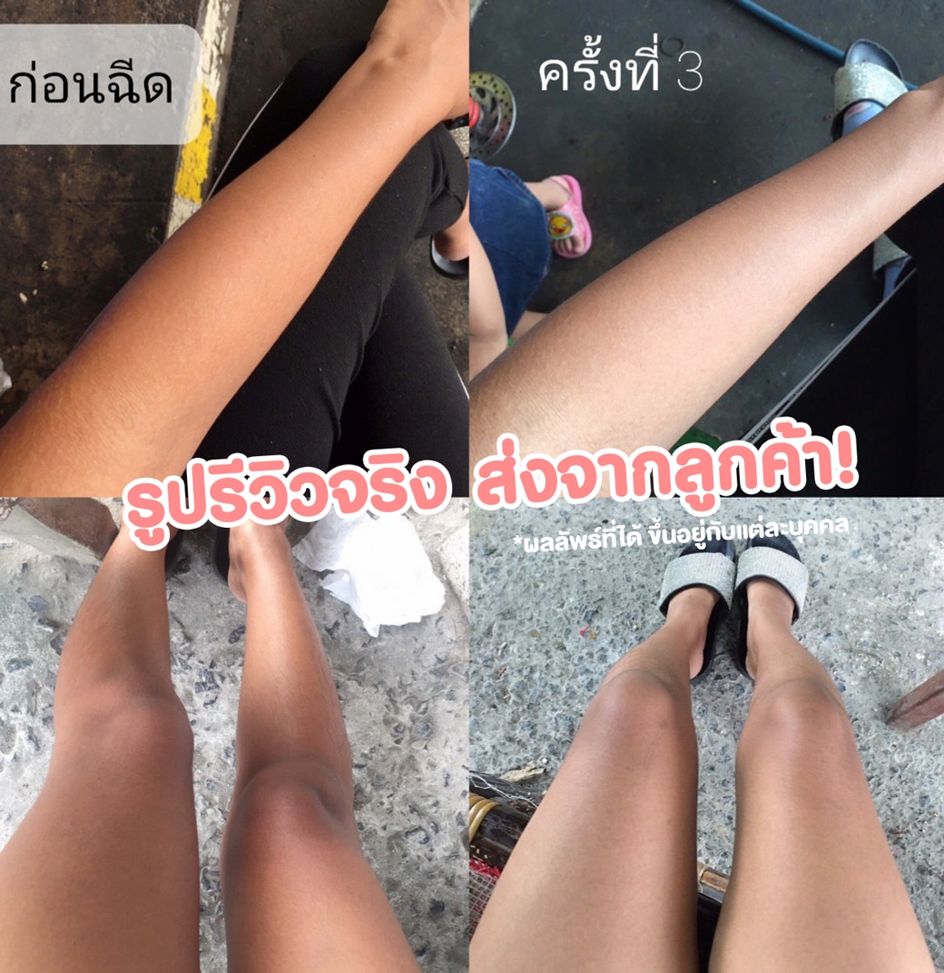 รีวิวฉีดผิว จากลูกค้า