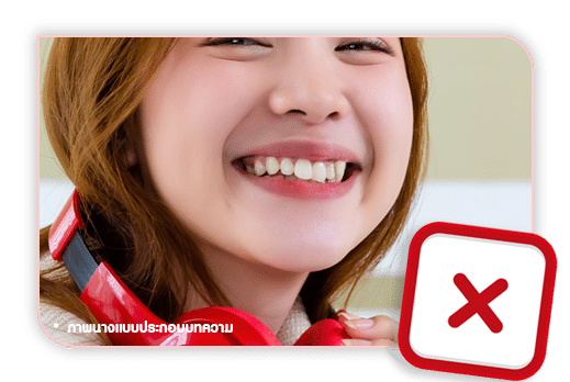 หลังร้อยไหม ไม่ควรอ้าปากจนสุด หรือ หัวเราะขยับใบหน้ามาก เพราะอาจทำให้ไหม คลายตัวลง หลังร้อยไหม ไม่ควรอ้าปากจนสุด หรือ หัวเราะขยับใบหน้ามาก เพราะอาจทำให้ไหม คลายตัวลง