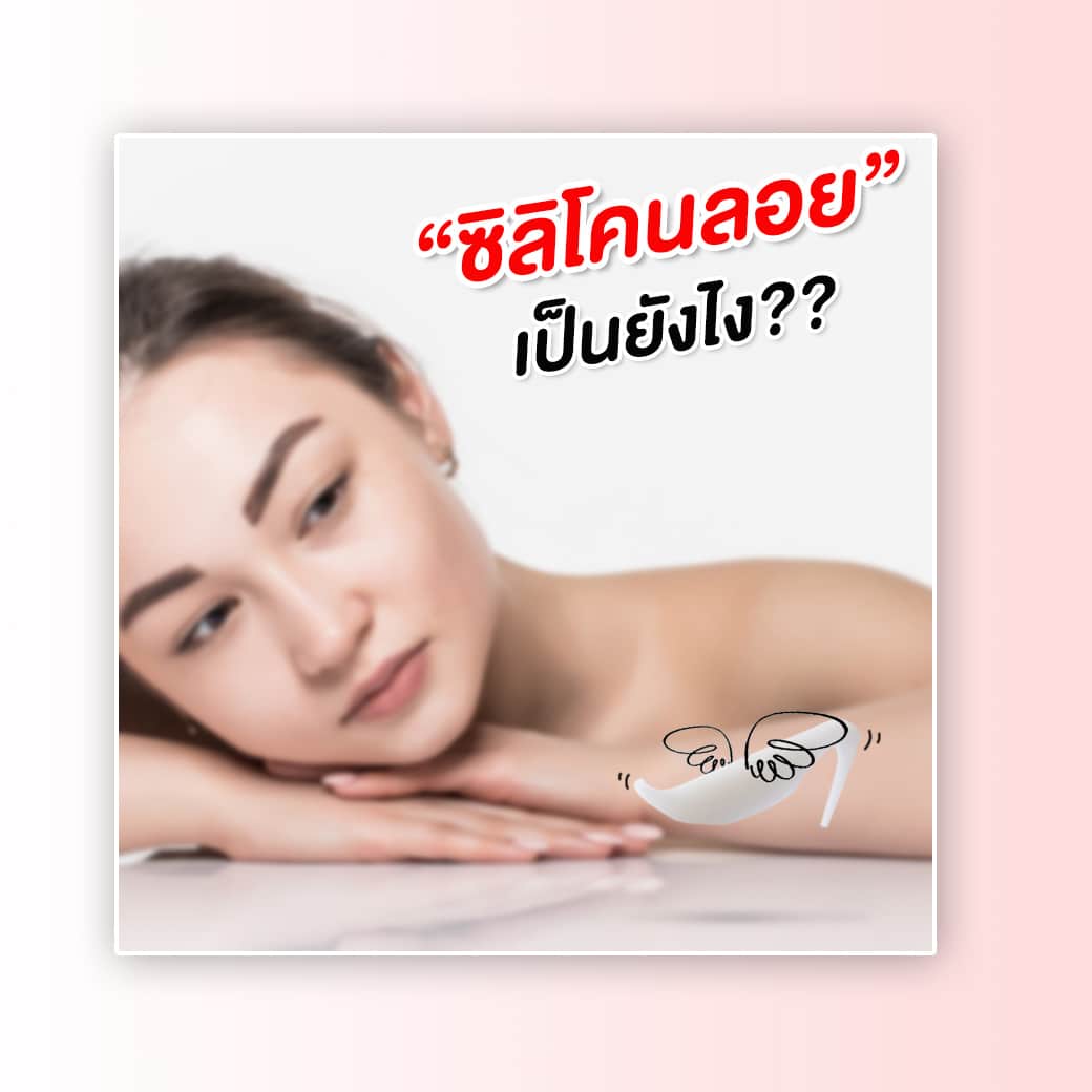 ซิลิโคนลอย เป็นยังไง