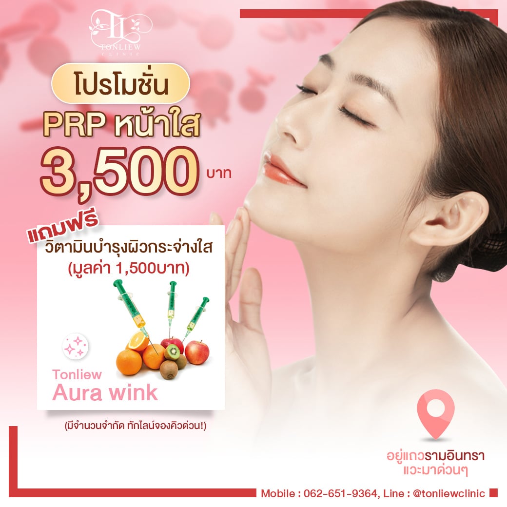 โปรโมชั่นฉีด PRP 3,500บาท แถมฟรีวิตามินบำรุงผิว
