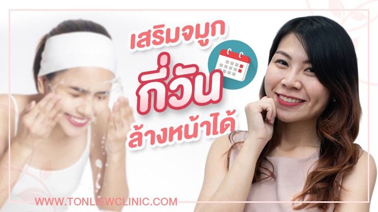 หลังทำจมูกกี่วันล้างหน้าได้ ? (ความรู้ที่ควรแบ่งปัน)