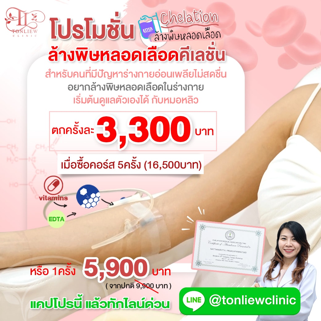 โปรโมชั่นล้างพิษหลอดเลือดคีเลชั่น chelation 3,300บาท