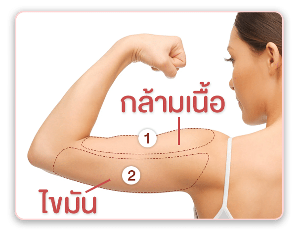 โครงสร้างแขน เพื่อดูดไขมันต้นแขน