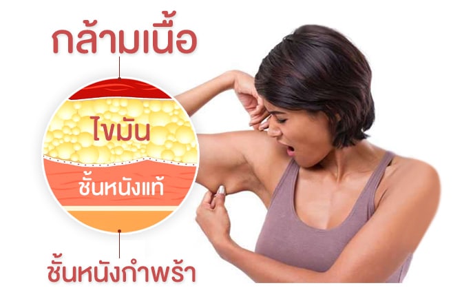 ชั้นผิว ภายในต้นแขน