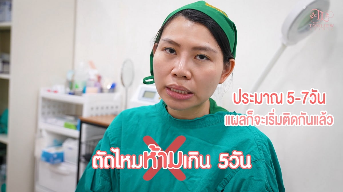 ห้ามตัดไหมเกิน 5วัน