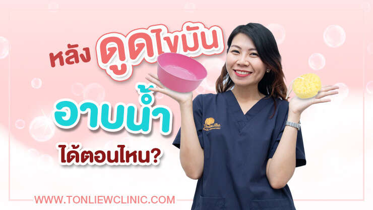 หลังดูดไขมัน อาบน้ำได้ตอนไหน ?