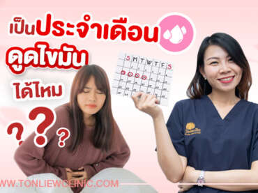 เป็นประจำเดือน ดูดไขมันได้ไหม ?