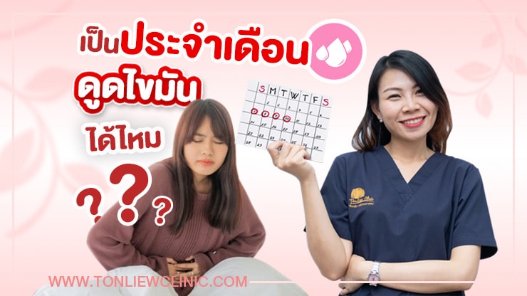 เป็นประจำเดือน ดูดไขมันได้ไหม ?