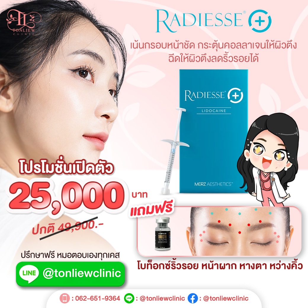 โปรโมชั่นพิเศษ Radiesse ราคาเปิดตัว